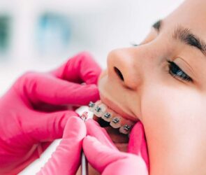 dental clinics for braces in Singapore