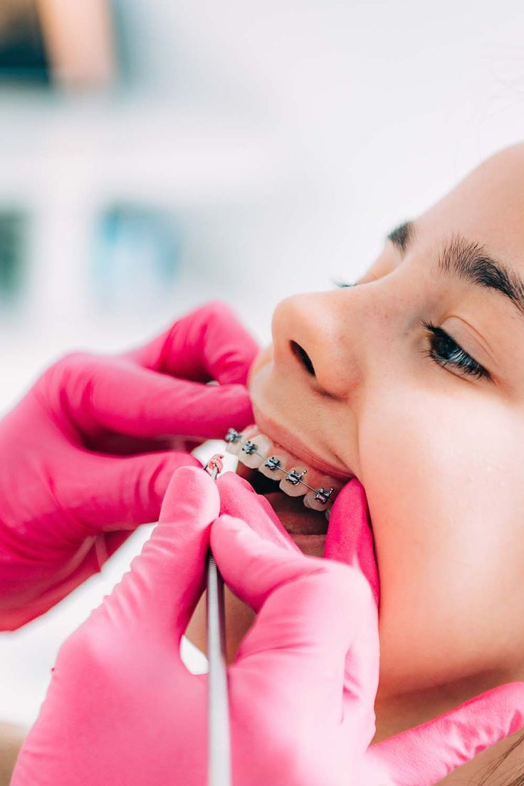 dental clinics for braces in Singapore
